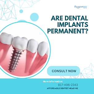 Fort Worth's Most Affordable Dentist Offering Payment Plans That Fit Your Budget